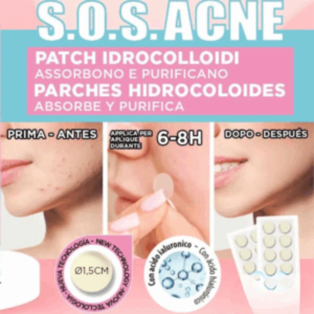 S.O.S. ACNE HYDROCOLLOID PATCHES – Αυτοκόλλητα κατά της Ακμής (20τμχ) - Image 2